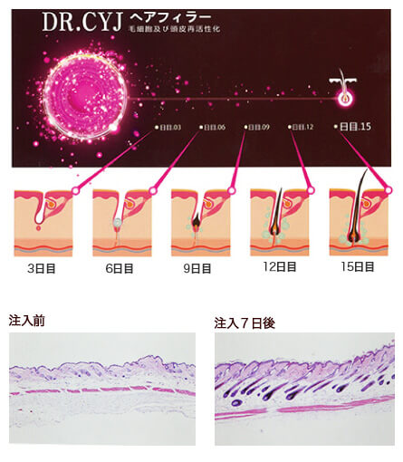 Dr.CYJヘアーフィラーの特徴