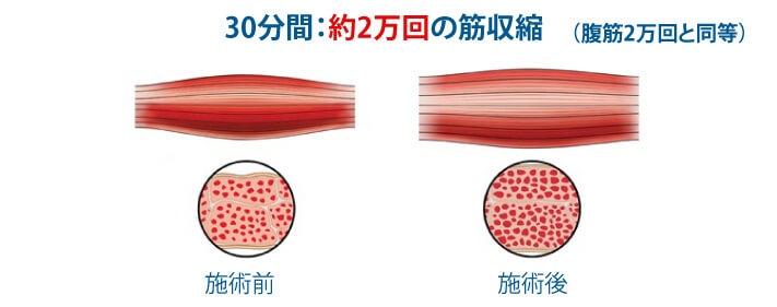 30分間：約2万回の筋収縮