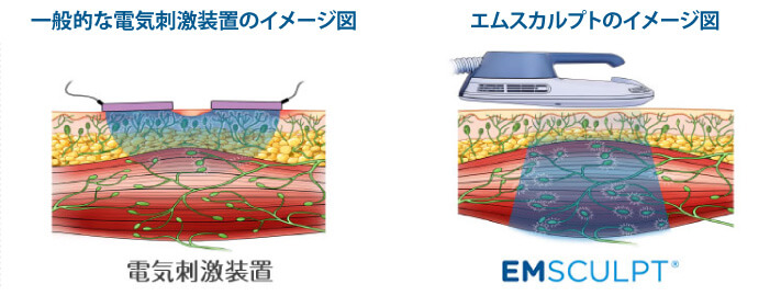 （EMSなど）より、はるかに深い7cmまで到達