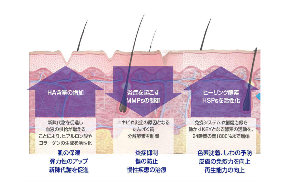 肌の老化にも、皮膚疾患にも、LDM-水玉リフティングはマルチに対応