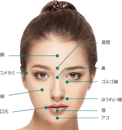 Fineha contour（ヒアルロン酸）の注入可能部位