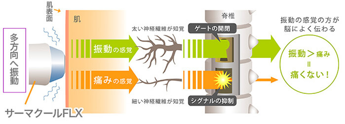 ゲートコントロール理論で熱感を緩和