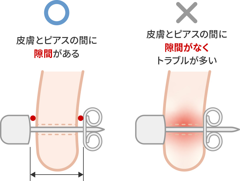 キャッチ(留め具部分)の締め過ぎに注意