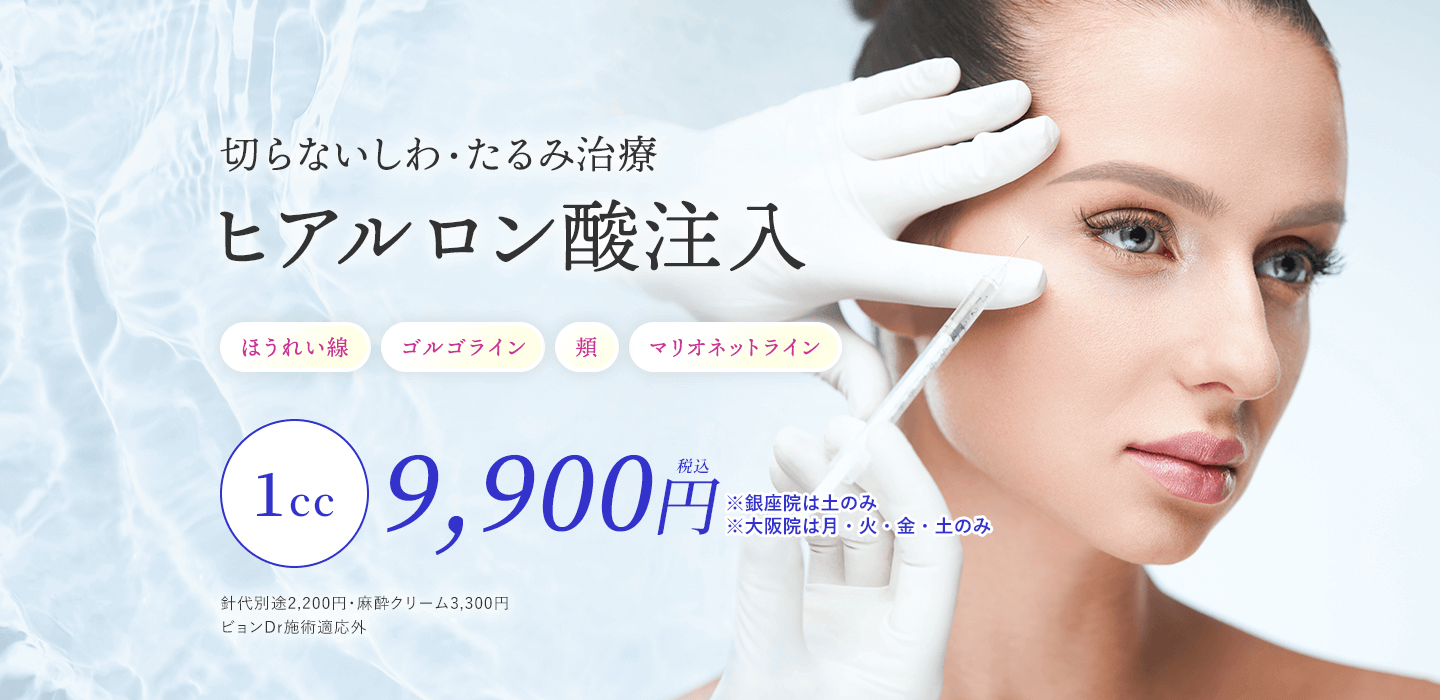 ヒアルロン酸注入