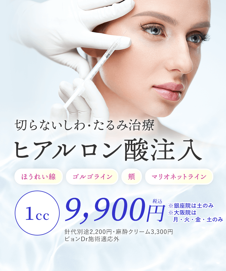 ヒアルロン酸注入