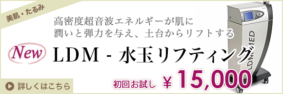 LDM水玉リフティング